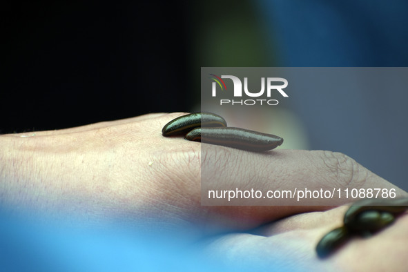 A local practitioner is placing leeches on the hand of a man to suck impure blood as a means of skin treatment in celebration of Nowruz, the...