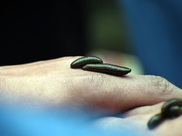 A local practitioner is placing leeches on the hand of a man to suck impure blood as a means of skin treatment in celebration of Nowruz, the...