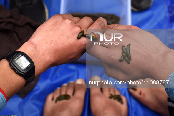 A local practitioner is placing leeches on the hands and feet of a man to suck impure blood as a means of skin treatment in celebration of N...