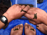 A local practitioner is placing leeches on the hands and feet of a man to suck impure blood as a means of skin treatment in celebration of N...