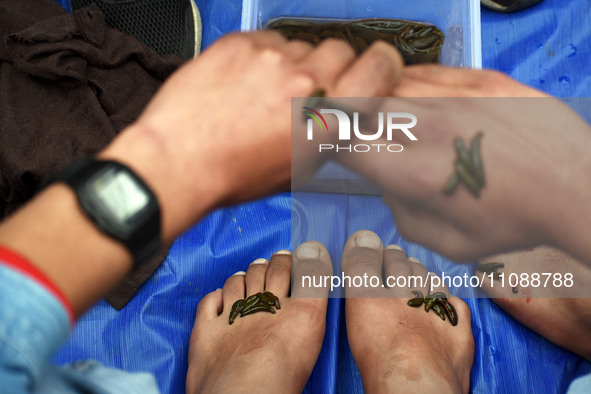 A local practitioner is placing leeches on the hands and feet of a man to suck impure blood as a means of skin treatment in celebration of N...