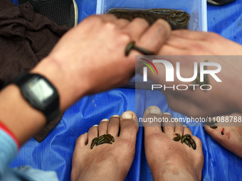 A local practitioner is placing leeches on the hands and feet of a man to suck impure blood as a means of skin treatment in celebration of N...