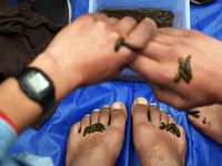 A local practitioner is placing leeches on the hands and feet of a man to suck impure blood as a means of skin treatment in celebration of N...