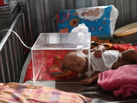 A child is receiving medical treatment for pneumonia at Dhaka Child Hospital amid an ongoing heatwave in Dhaka, Bangladesh, on April 21, 202...