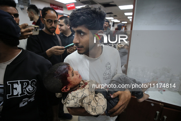 Palestinians are transporting an injured person to the Al-Aqsa Martyrs Hospital in Deir Balah in the central Gaza Strip, on April 24, 2024,...