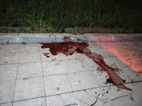 Bloodstains are visible on the ground in Odesa, Ukraine, on April 29, 2024, following a Russian missile attack that has killed five people....