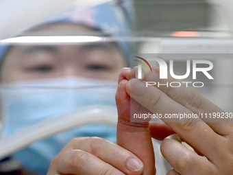 A nurse is giving a physical examination to a newborn in the neonatal intensive care unit of the No 4 Hospital in Handan, Hebei Province, No...