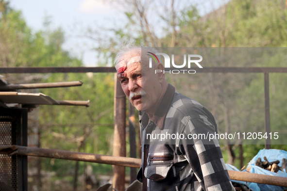 A 75-year-old local resident, Anatolii Staroselets, is suffering from injuries caused by Russian shelling with KAB guided aerial bombs in De...