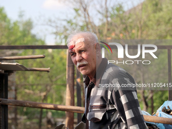 A 75-year-old local resident, Anatolii Staroselets, is suffering from injuries caused by Russian shelling with KAB guided aerial bombs in De...