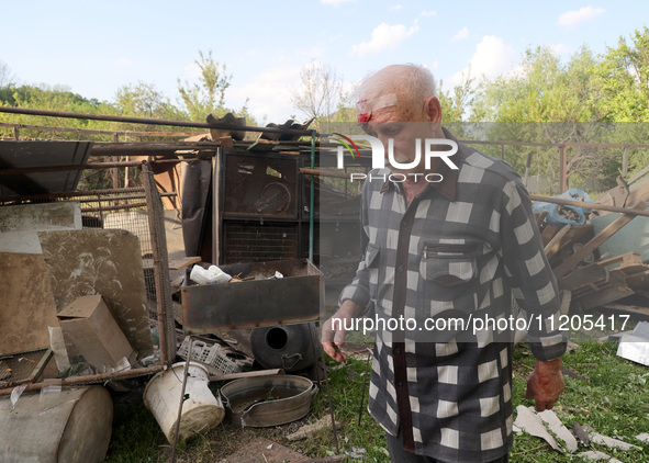 A 75-year-old local resident, Anatolii Staroselets, is suffering from injuries caused by Russian shelling with KAB guided aerial bombs in De...