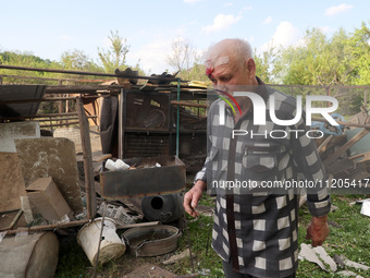 A 75-year-old local resident, Anatolii Staroselets, is suffering from injuries caused by Russian shelling with KAB guided aerial bombs in De...