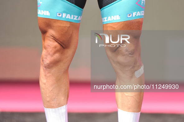 Legs details of Domenico Pozzovivo of Italy and Team VF Group - Bardiani CSF - Faizane  prior to the 107th Giro d'Italia 2024, Stage 12, a 1...