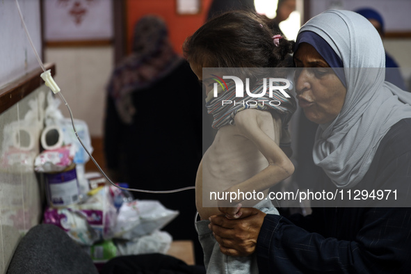 A Palestinian child is suffering from malnutrition and is receiving treatment at Al-Aqsa Martyrs Hospital in Deir al-Balah in the central Ga...