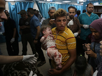 Palestinians are rushing a person into Al-Aqsa Martyrs Hospital in Deir el-Balah in the central Gaza Strip following Israeli bombardment. In...