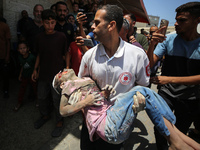 An injured girl is being brought to the al-Aqsa Martyrs Hospital in Deir al-Balah, in the central Gaza Strip, following the Israeli bombardm...