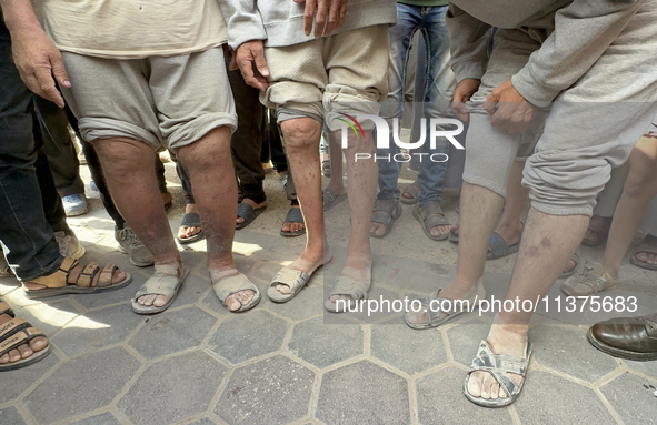 Palestinian men who are being detained by Israeli forces are arriving after their release for a check-up at the Al-Aqsa Martyrs Hospital in...