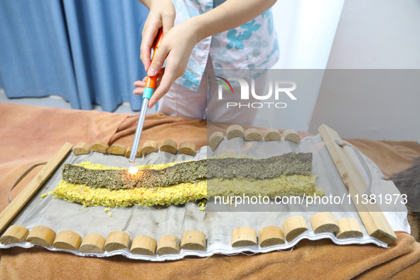 A doctor in the department of acupuncture and massage at a traditional Chinese medicine hospital is giving a person a moxibustion to help hi...