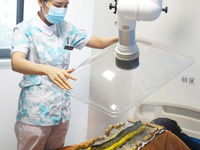 A doctor in the department of acupuncture and massage at a traditional Chinese medicine hospital is giving a person a moxibustion to help hi...