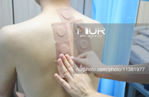 A doctor in the department of acupuncture and massage at a traditional Chinese Medicine hospital is applying the ''Sanfu Patch'' to citizens...