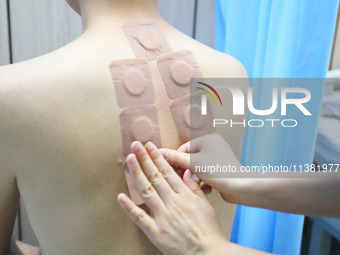 A doctor in the department of acupuncture and massage at a traditional Chinese Medicine hospital is applying the ''Sanfu Patch'' to citizens...