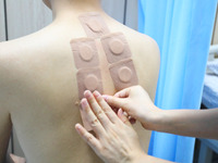 A doctor in the department of acupuncture and massage at a traditional Chinese Medicine hospital is applying the ''Sanfu Patch'' to citizens...