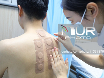 A doctor in the department of acupuncture and massage at a traditional Chinese Medicine hospital is applying the ''Sanfu Patch'' to citizens...