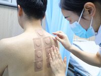 A doctor in the department of acupuncture and massage at a traditional Chinese Medicine hospital is applying the ''Sanfu Patch'' to citizens...