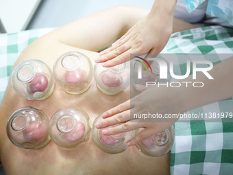 A doctor of acupuncture and massage at a traditional Chinese Medicine hospital is giving cupping treatment to a citizen in Chongqing, China,...