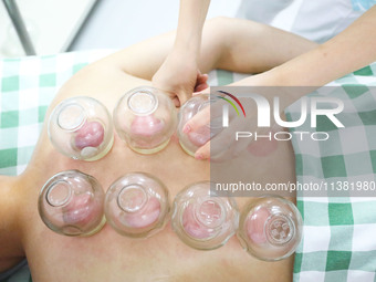 A doctor of acupuncture and massage at a traditional Chinese Medicine hospital is giving cupping treatment to a citizen in Chongqing, China,...