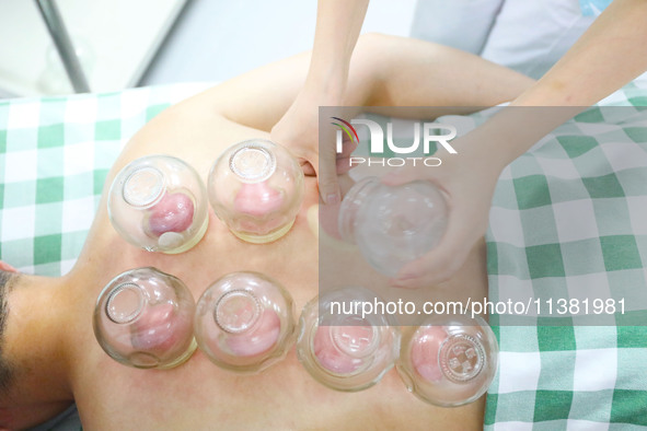 A doctor of acupuncture and massage at a traditional Chinese Medicine hospital is giving cupping treatment to a citizen in Chongqing, China,...