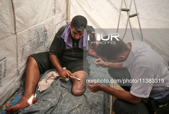 Muattaz Abu Dayeh, a physiotherapist, is applying a medical prosthesis to 32-year-old worker Majd al-Omari, who lost part of his leg during...