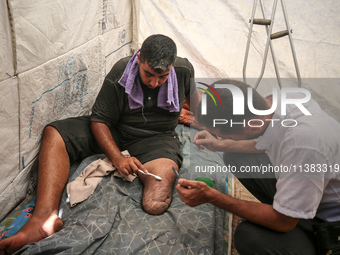 Muattaz Abu Dayeh, a physiotherapist, is applying a medical prosthesis to 32-year-old worker Majd al-Omari, who lost part of his leg during...