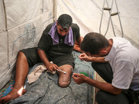 Muattaz Abu Dayeh, a physiotherapist, is applying a medical prosthesis to 32-year-old worker Majd al-Omari, who lost part of his leg during...