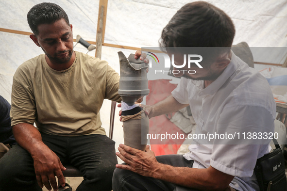 Muattaz Abu Dayeh, a physiotherapist, is applying a medical prosthesis to 32-year-old worker Majd al-Omari, who lost part of his leg during...