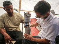 Muattaz Abu Dayeh, a physiotherapist, is applying a medical prosthesis to 32-year-old worker Majd al-Omari, who lost part of his leg during...