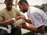 Muattaz Abu Dayeh, a physiotherapist, is applying a medical prosthesis to 32-year-old worker Majd al-Omari, who lost part of his leg during...