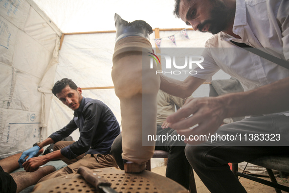 Muattaz Abu Dayeh, a physiotherapist, is applying a medical prosthesis to 32-year-old worker Majd al-Omari, who lost part of his leg during...