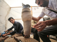 Muattaz Abu Dayeh, a physiotherapist, is applying a medical prosthesis to 32-year-old worker Majd al-Omari, who lost part of his leg during...