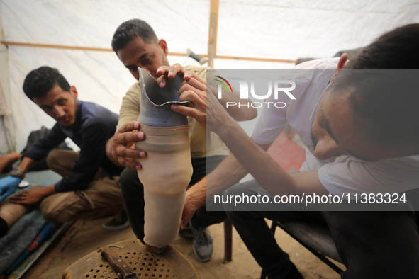 Muattaz Abu Dayeh, a physiotherapist, is applying a medical prosthesis to 32-year-old worker Majd al-Omari, who lost part of his leg during...