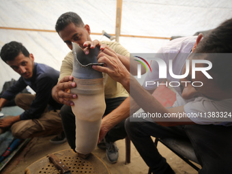 Muattaz Abu Dayeh, a physiotherapist, is applying a medical prosthesis to 32-year-old worker Majd al-Omari, who lost part of his leg during...