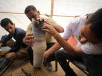 Muattaz Abu Dayeh, a physiotherapist, is applying a medical prosthesis to 32-year-old worker Majd al-Omari, who lost part of his leg during...