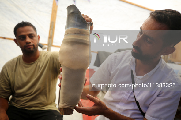 Muattaz Abu Dayeh, a physiotherapist, is applying a medical prosthesis to 32-year-old worker Majd al-Omari, who lost part of his leg during...