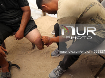 Muattaz Abu Dayeh, a physiotherapist, is applying a medical prosthesis to 32-year-old worker Majd al-Omari, who lost part of his leg during...