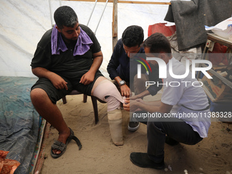 Muattaz Abu Dayeh, a physiotherapist, is applying a medical prosthesis to 32-year-old worker Majd al-Omari, who is losing part of his leg du...