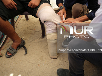 Muattaz Abu Dayeh, a physiotherapist, is applying a medical prosthesis to 32-year-old worker Majd al-Omari, who is losing part of his leg du...