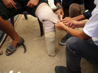 Muattaz Abu Dayeh, a physiotherapist, is applying a medical prosthesis to 32-year-old worker Majd al-Omari, who is losing part of his leg du...