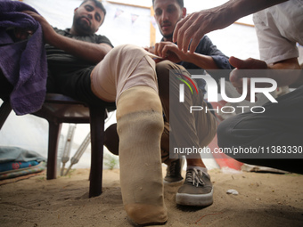 Muattaz Abu Dayeh, a physiotherapist, is applying a medical prosthesis to 32-year-old worker Majd al-Omari, who is losing part of his leg du...