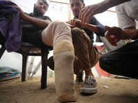 Muattaz Abu Dayeh, a physiotherapist, is applying a medical prosthesis to 32-year-old worker Majd al-Omari, who is losing part of his leg du...