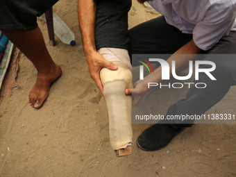 Muattaz Abu Dayeh, a physiotherapist, is applying a medical prosthesis to 32-year-old worker Majd al-Omari, who lost part of his leg during...