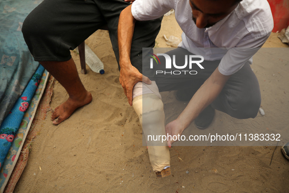 Muattaz Abu Dayeh, a physiotherapist, is applying a medical prosthesis to 32-year-old worker Majd al-Omari, who lost part of his leg during...